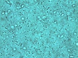 Микроскопическая картина нормальной спермы