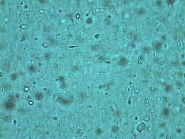 Микроскопическая картина при олигоспермии